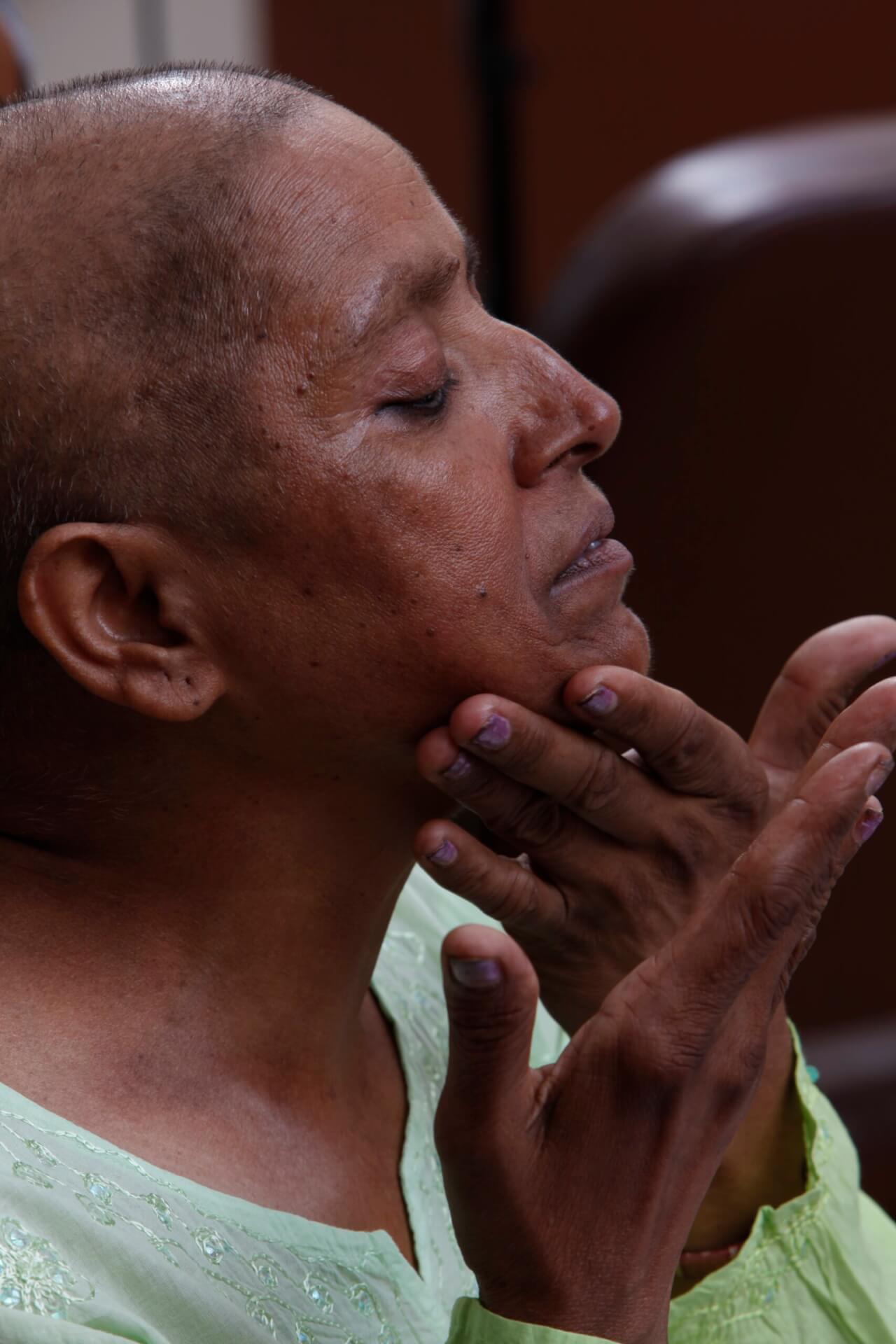 bald woman applying skincare product to her face